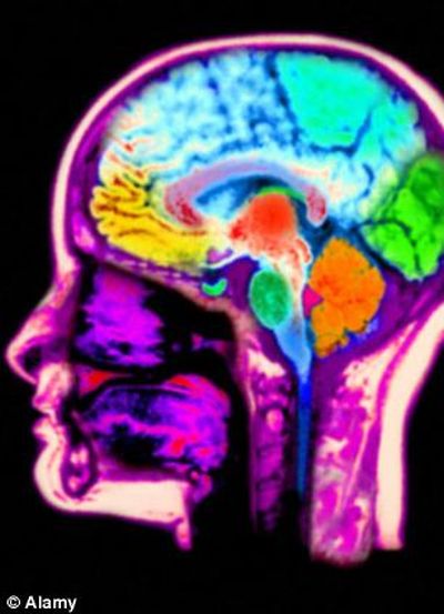 Area of the brain affected by playing video games