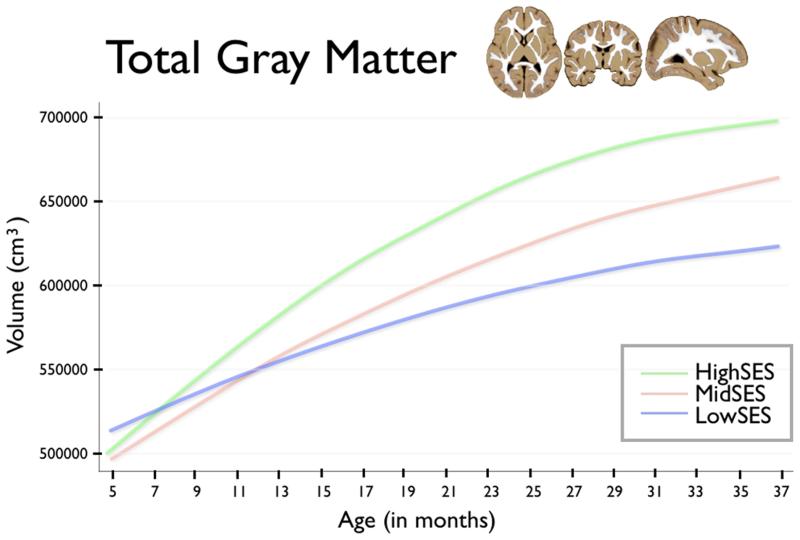 http://www.techietonics.com/wp-content/uploads/2013/12/poverty-and-brain.jpg