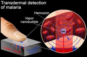 malaria