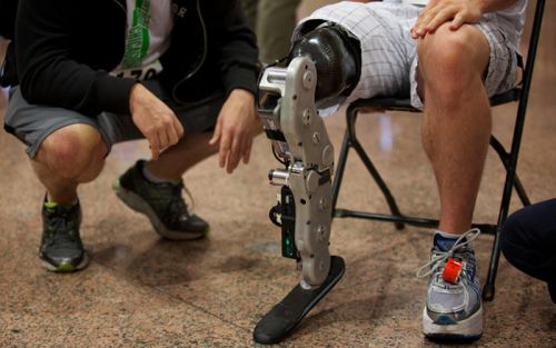 bionic-leg